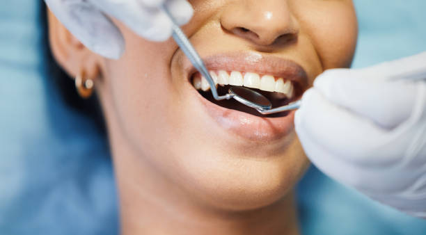 Best Chipped Tooth Repair Near Me  in La Vale, MD