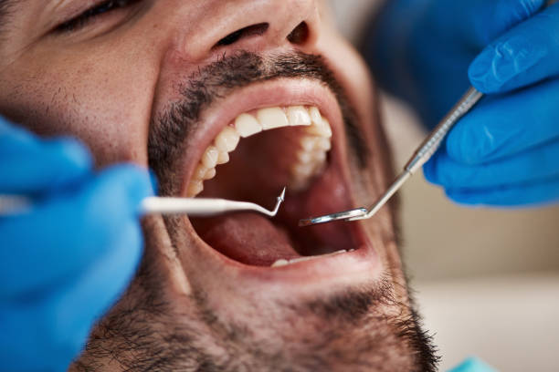 Best Cracked Tooth Emergency Dentist  in La Vale, MD
